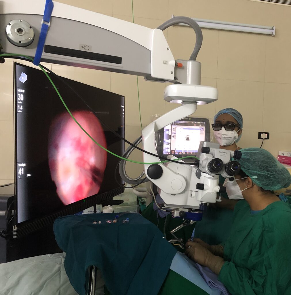 best eye specialist in gurgaon